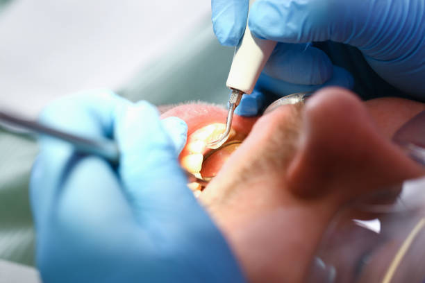 Best Emergency Treatment for Toothache in Dunn Loring, VA