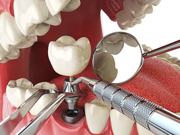 Best Emergency Dental Care for Trauma or Injury in Dunn Loring, VA
